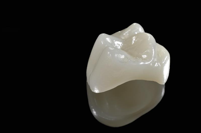 Porcelain Crowns Sugar Grove, IL